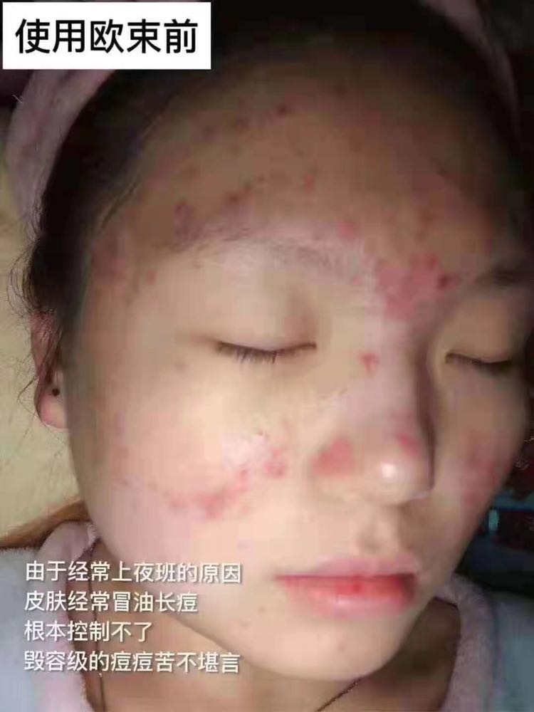 我是欧束合伙人想买产品想做代理的可以➕我了解