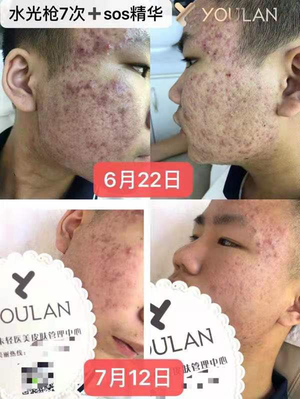 艾璐卡代理，赚钱，发家致富