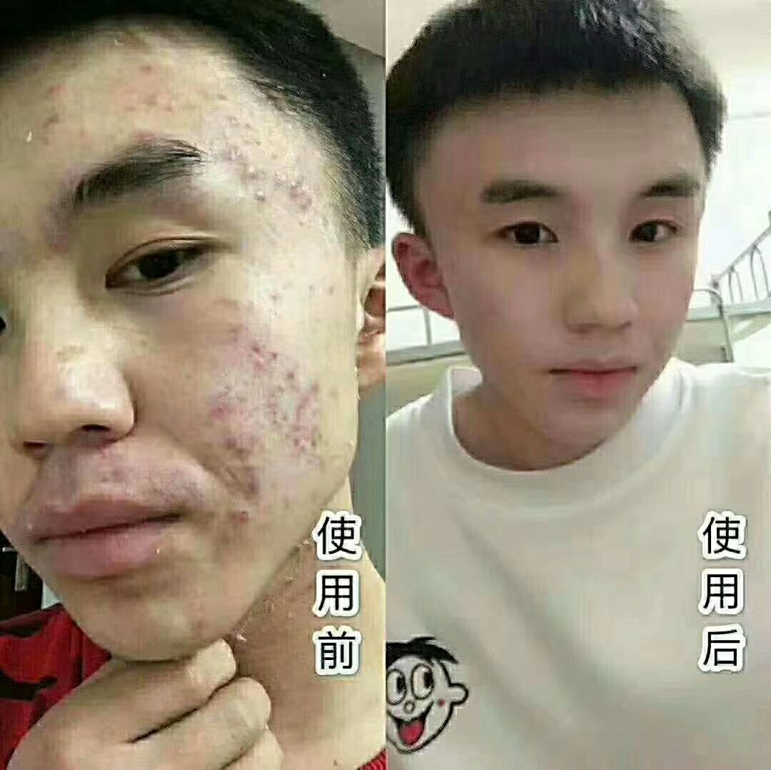 冰亦花瓣面膜.