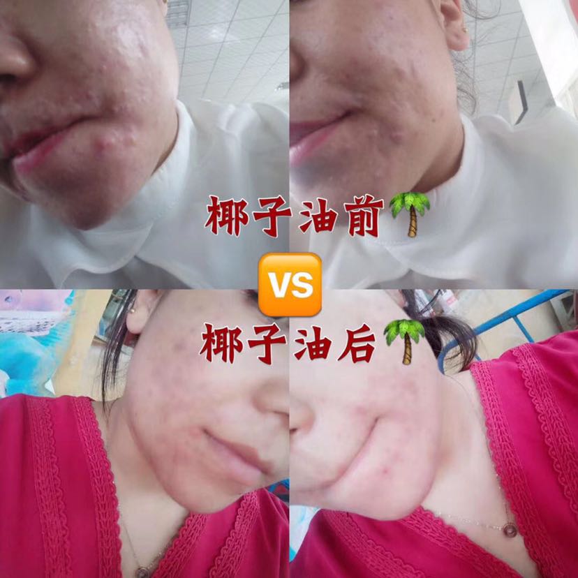 你想不想了解一下椰子油？