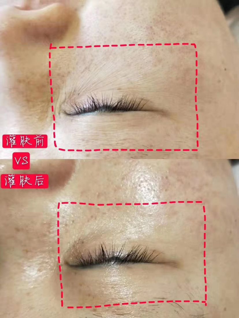 Dr.Mary 灌肤