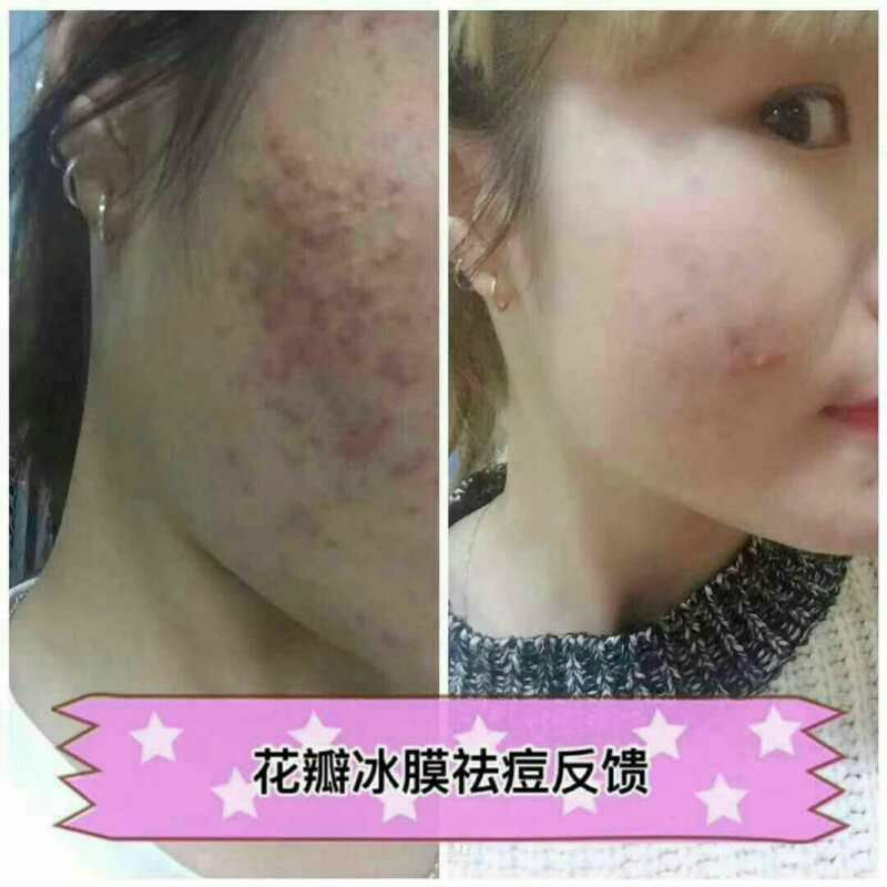 花瓣冰膜   瘦身果汁  口红