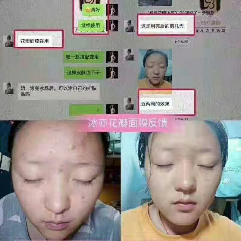 冰亦花瓣面膜.