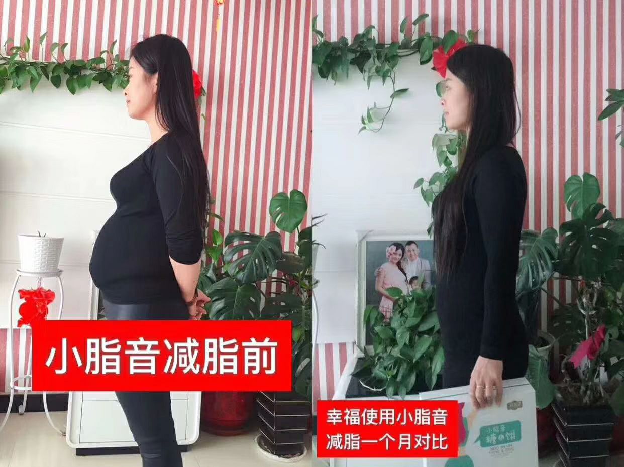 美妆护肤变美变瘦招代理
