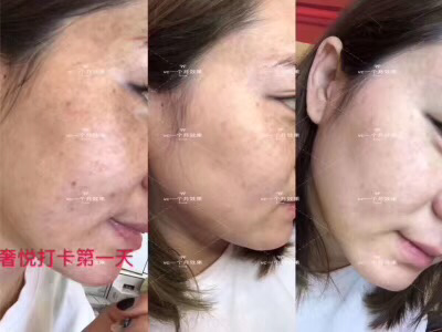 奢悦美白淡斑三件套 搭配效果惊人