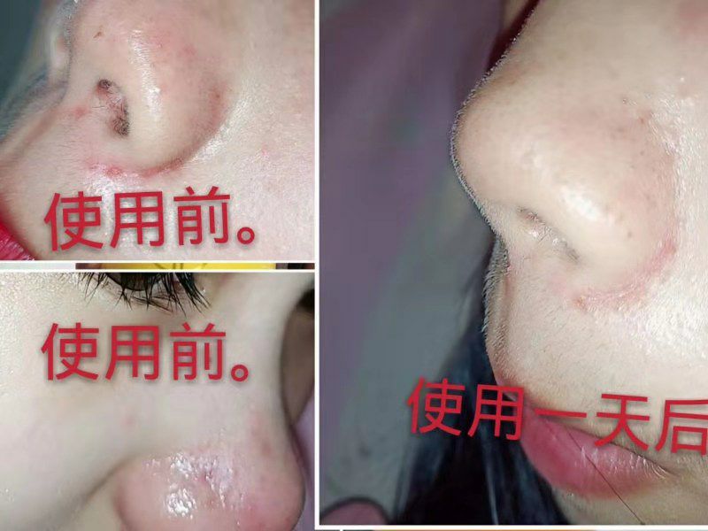 花瓣面膜主要功效：保湿，美白，祛痘，补水，安全的可以食用