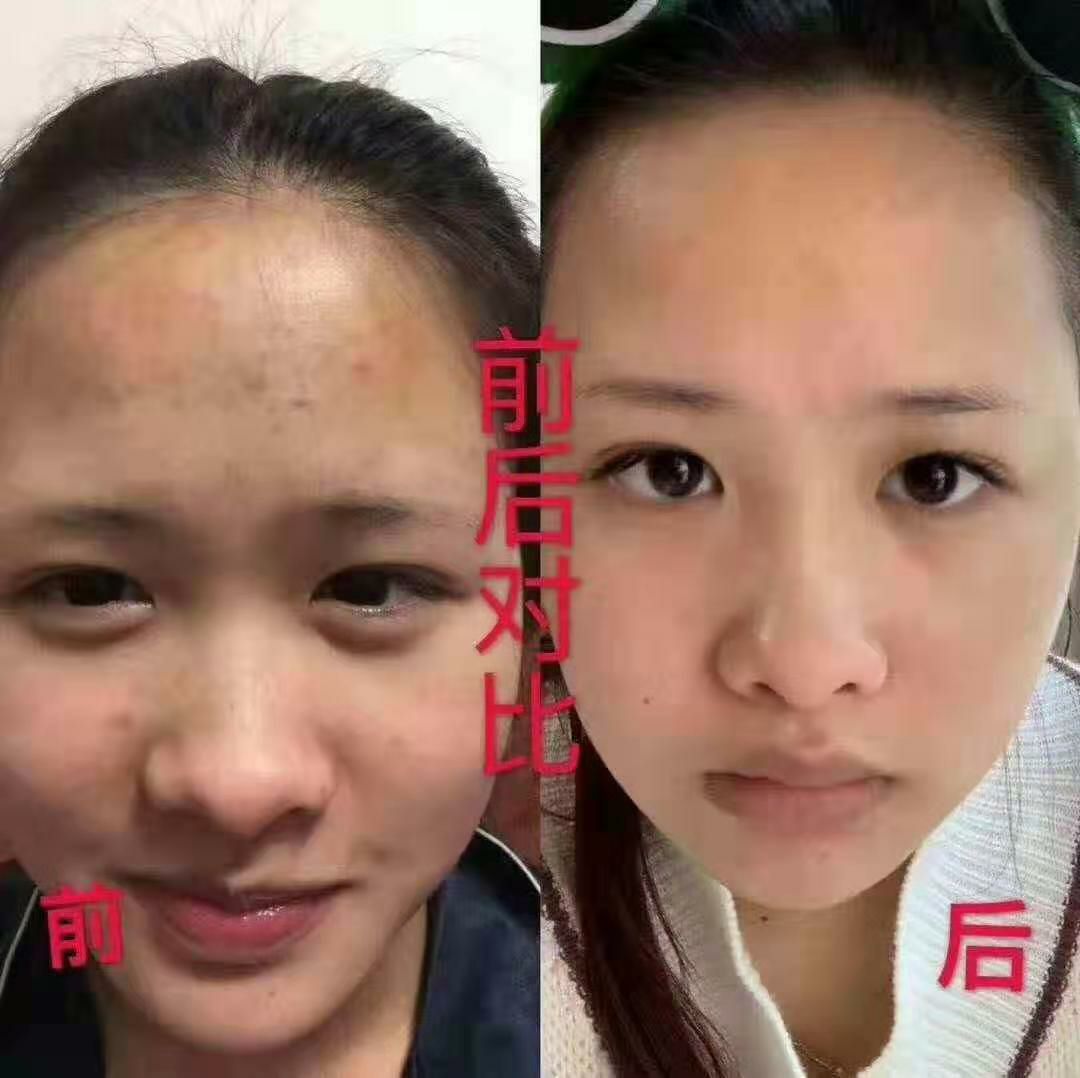 花瓣面膜主要功效：保湿，美白，祛痘，补水，安全的可以食用