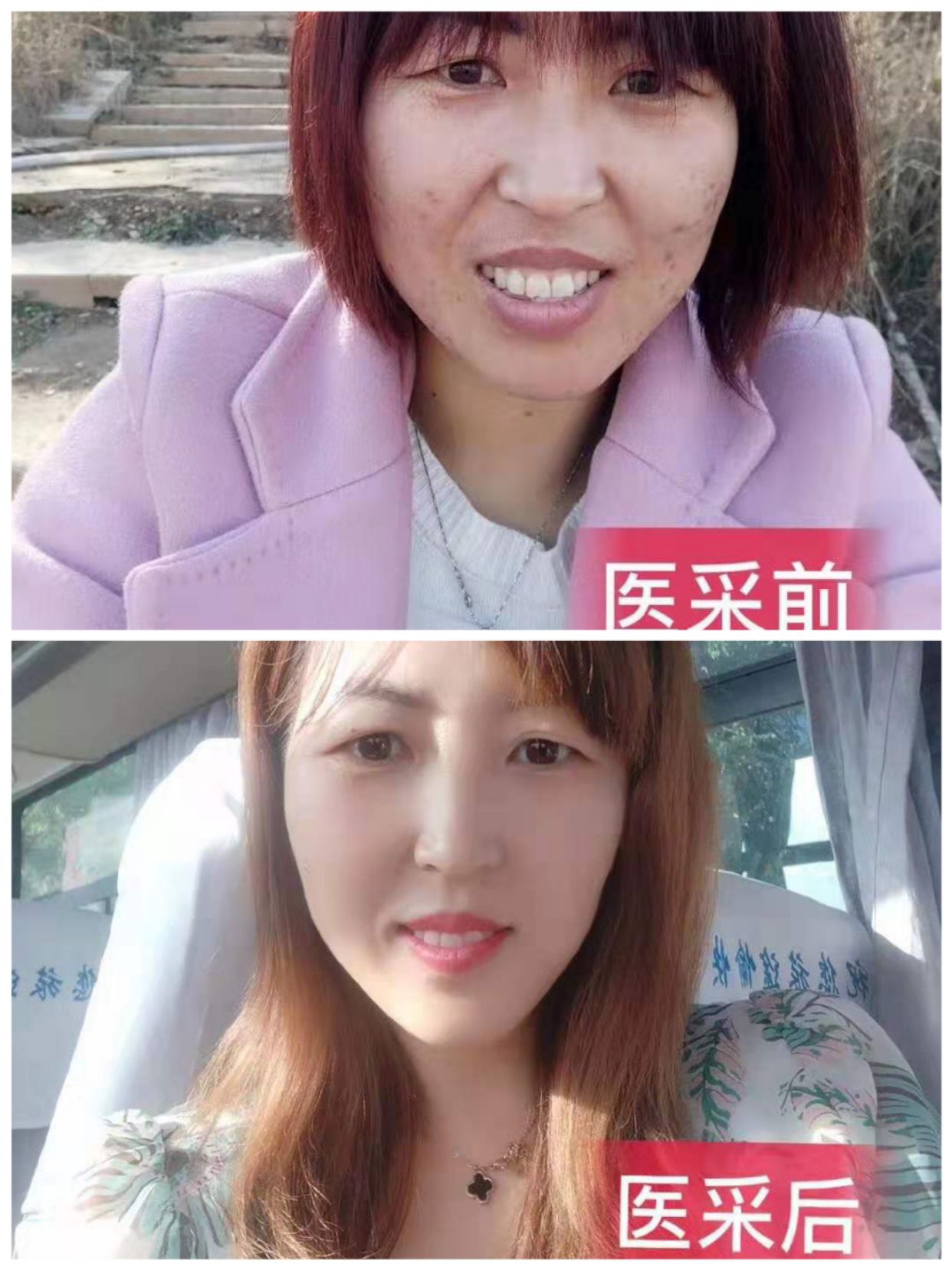 医采纯植物护肤，适合任何肌肤 诚招代理，优惠多多