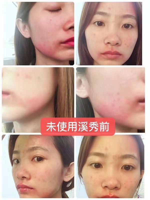 招溪秀代理，低门槛，199拿货，自用也行，卖给别人也行