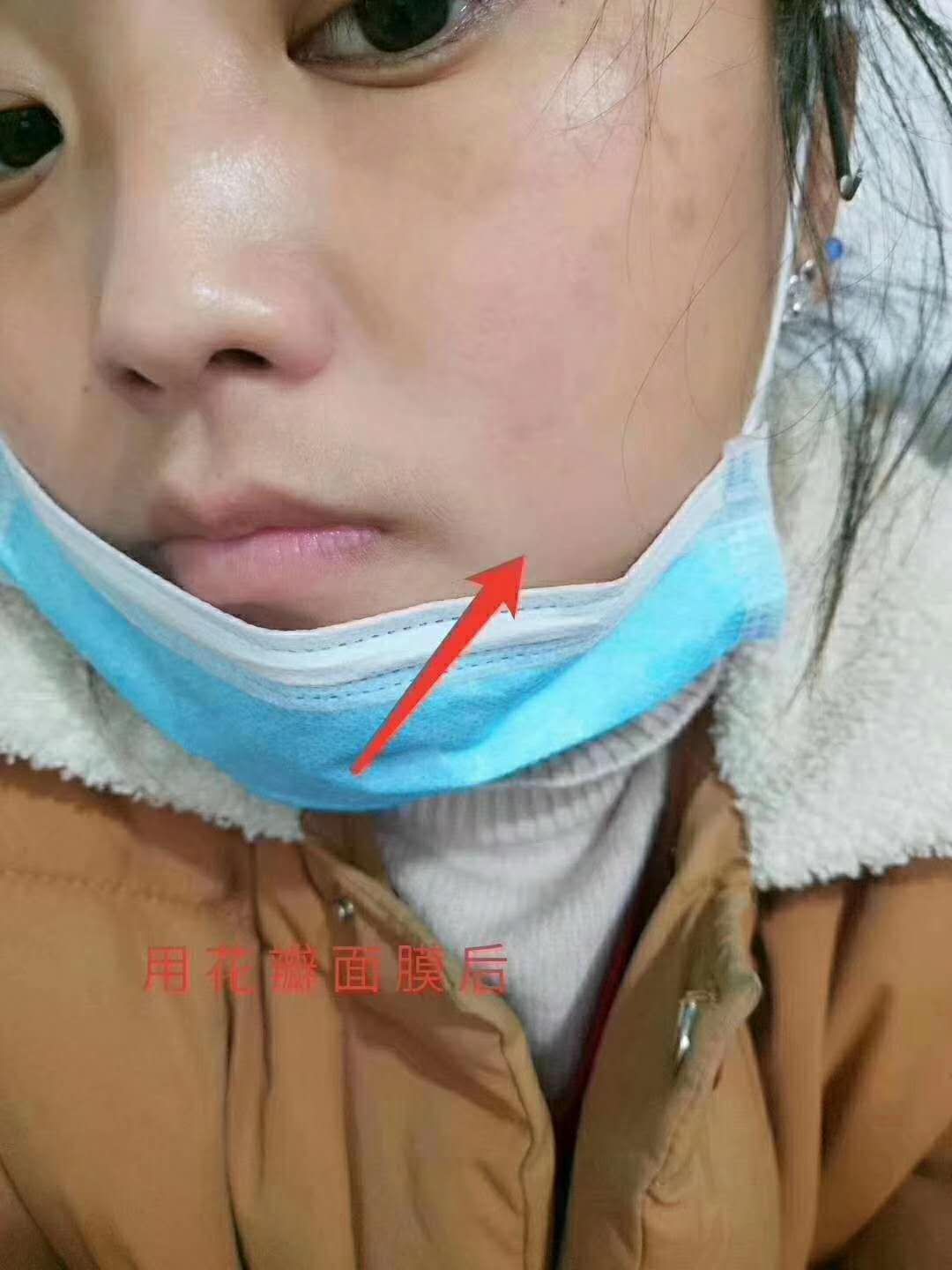 花瓣面膜 美白保湿祛痘祛红血丝