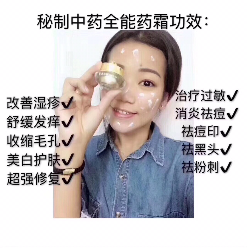 想要祛痘痘的可以加我微信,有实体店，两盒无效退款
