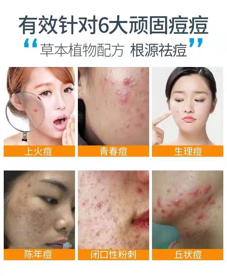 知音草清痘修复凝胶招代理