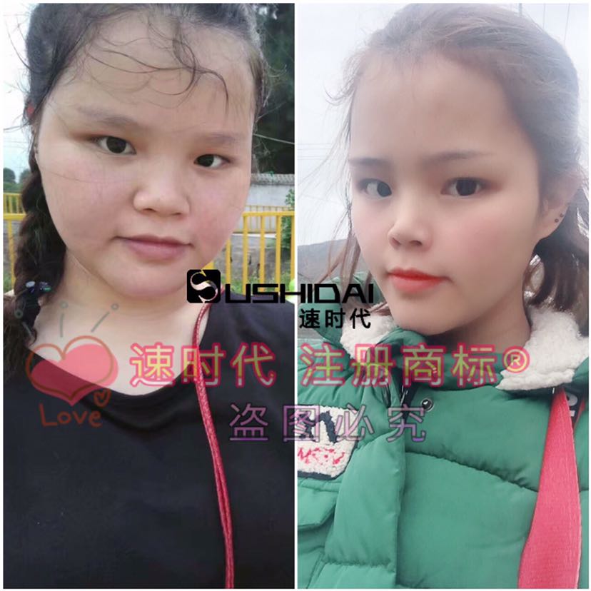 你肉肉的克星