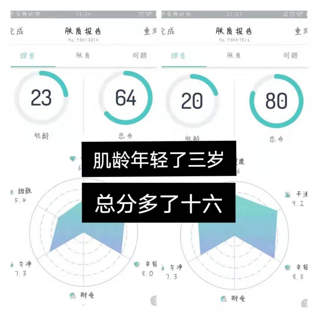 招代理，美白祛痘减肥，无效来找我退款