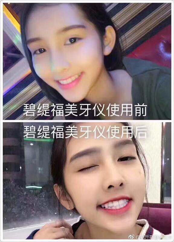 碧缇福冷光美白仪