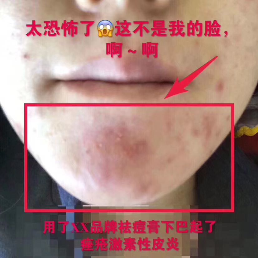 DHV带你变美