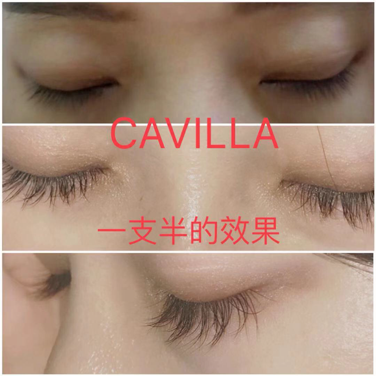 睫毛自身健康生长