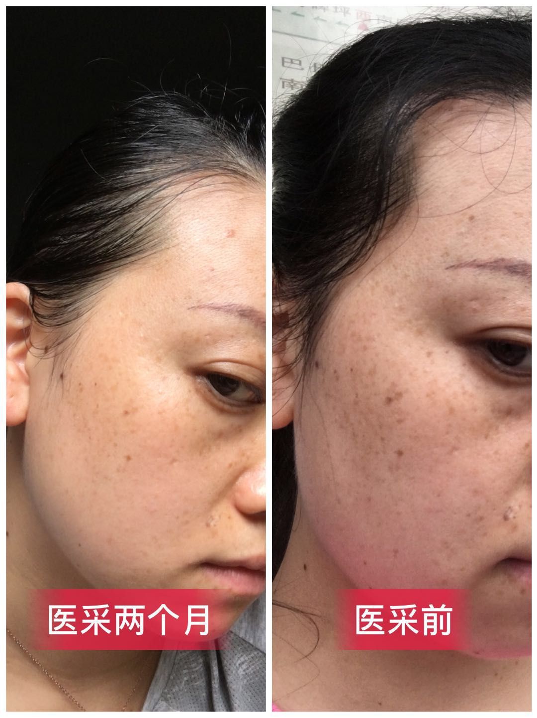 医采纯植物护肤，适合任何肌肤 诚招代理，优惠多多
