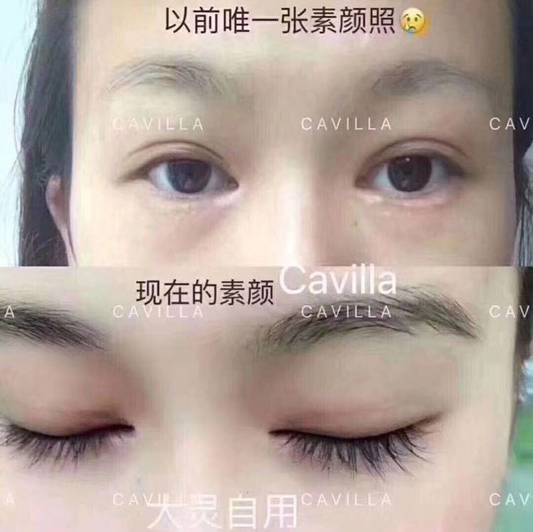睫毛自身健康生长