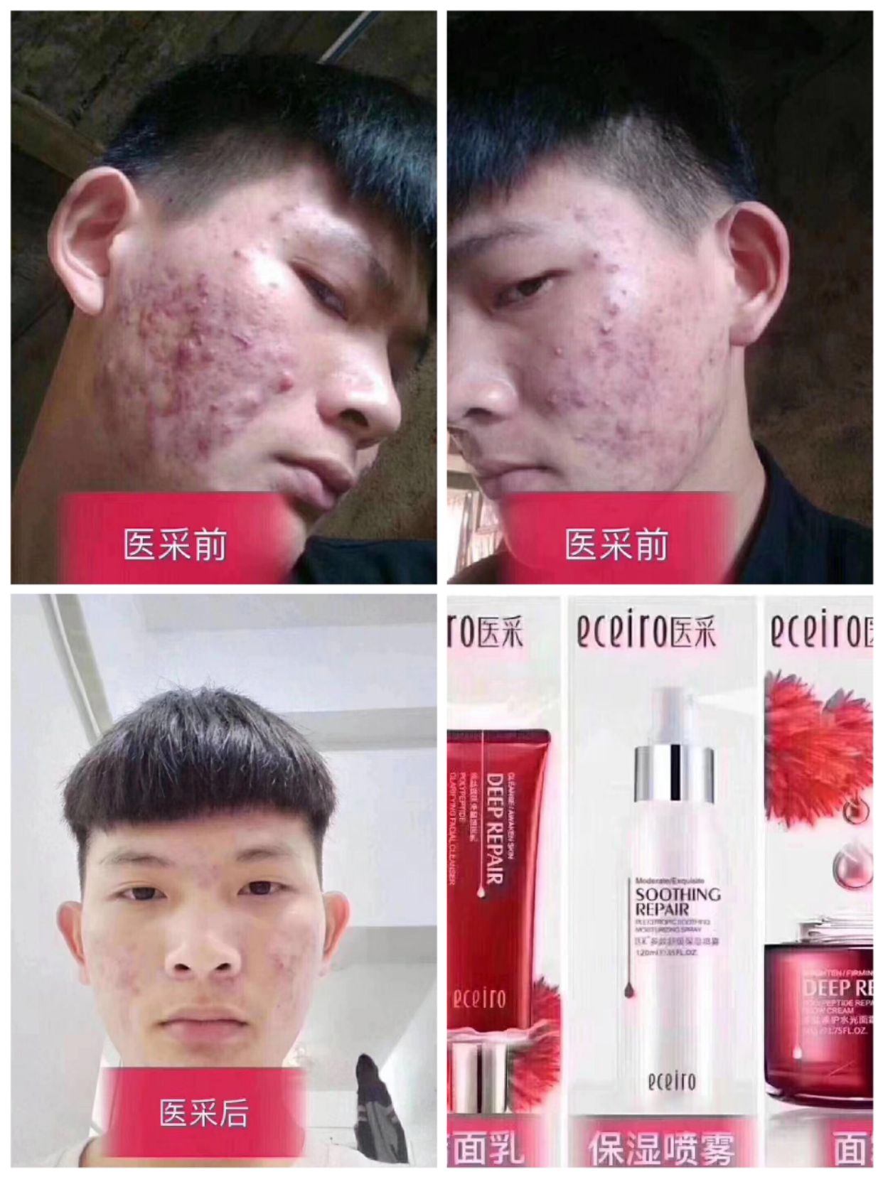 医采纯植物护肤，适合任何肌肤 诚招代理，优惠多多