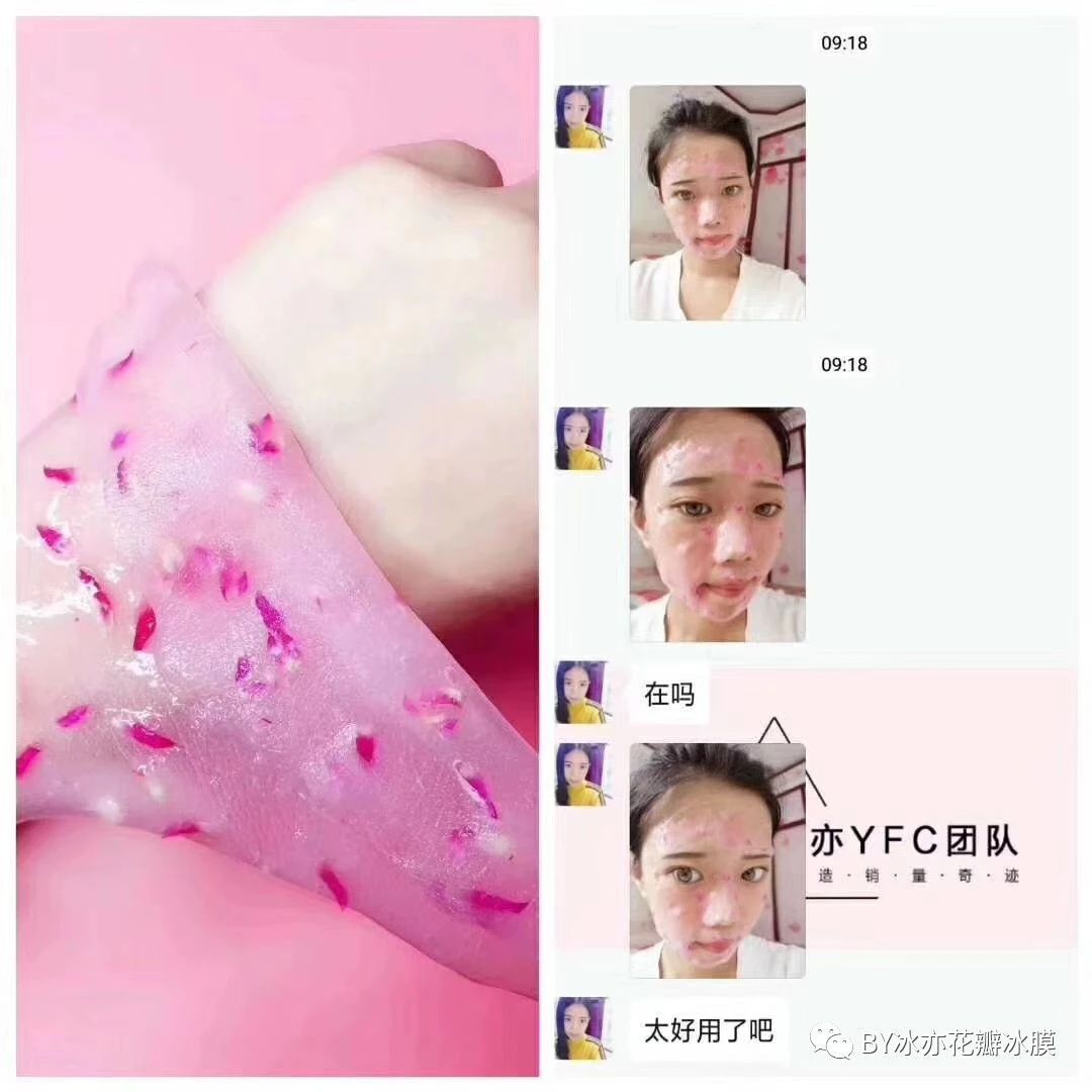 冰亦花瓣面