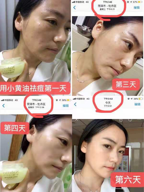 小黄油滴滴来大自然的精华逆转时光！焕颜新生一瓶多用！补水修复