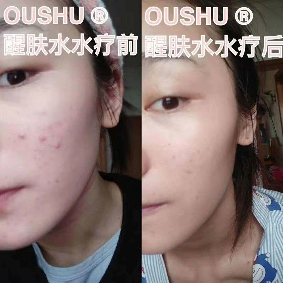 欧束公司最高战略合伙人楠三岁【招代理卖零售】