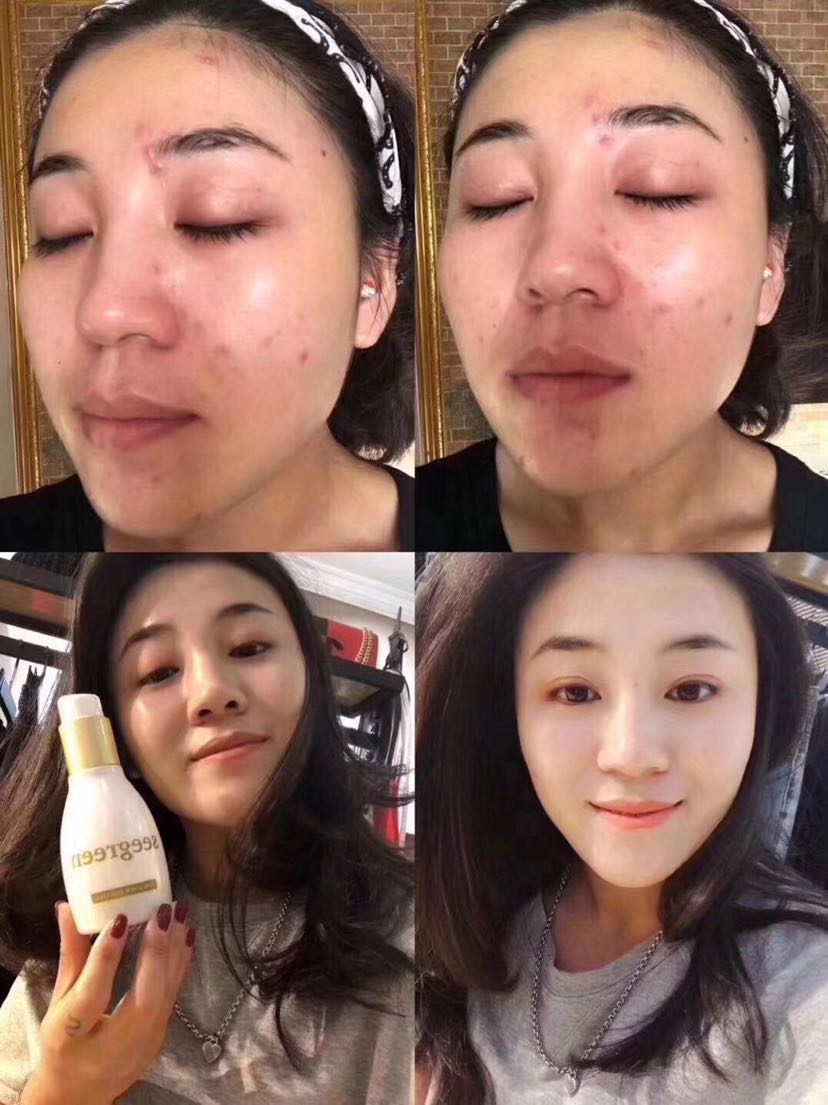 微晶是一款清洁神器，利用竹炭微晶粒子对毛孔进行清洁！