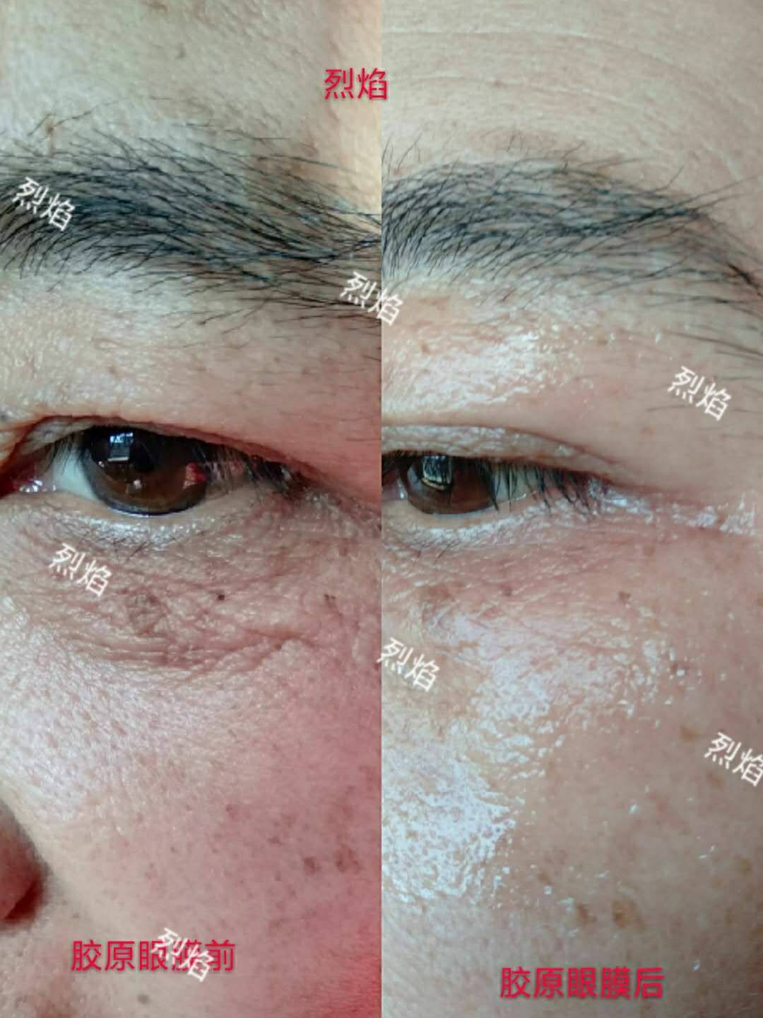 活性胶原眼膜 超级服帖 自带营养 滋养肌肤