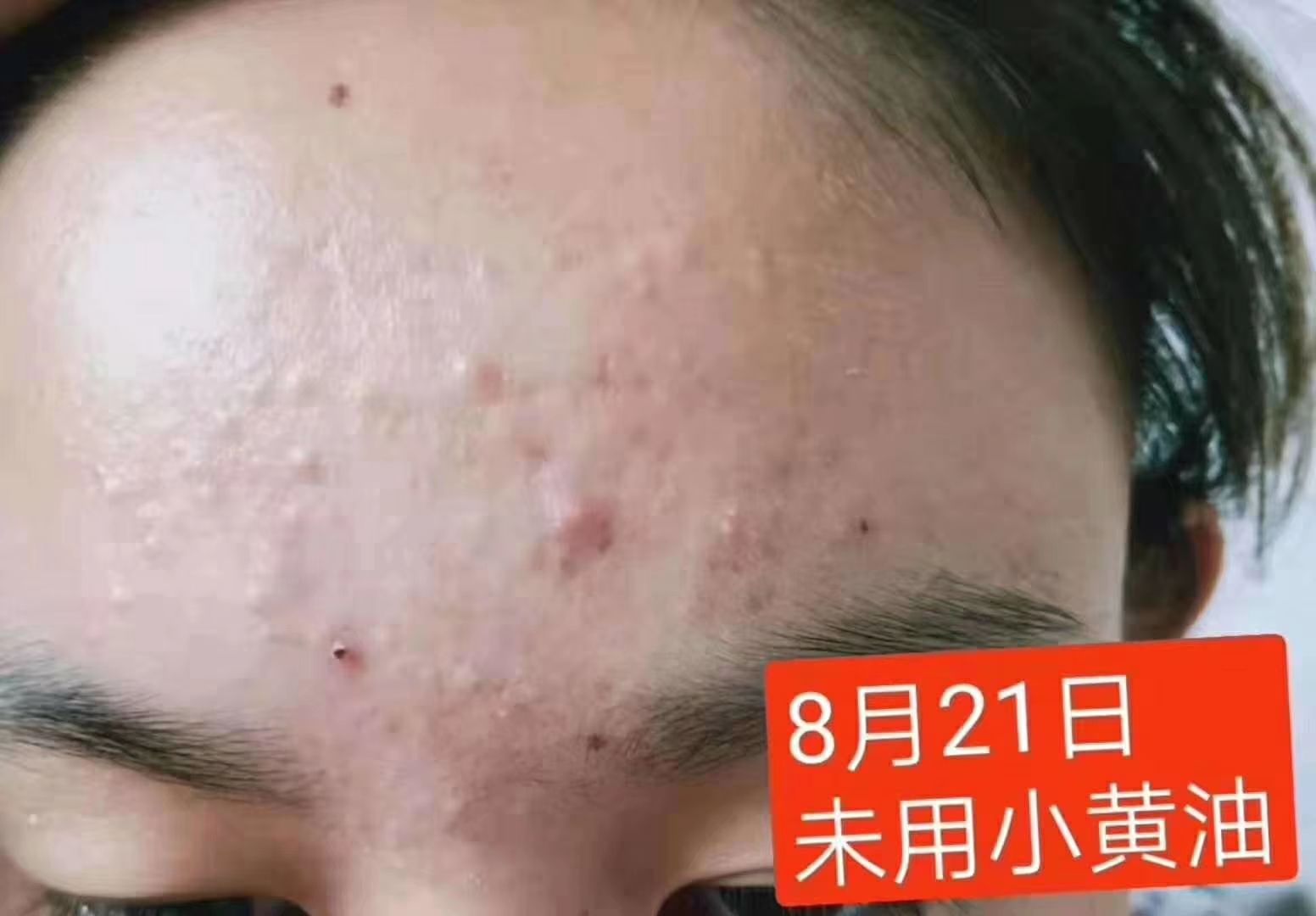 娜兰蒂姿小黄油套装