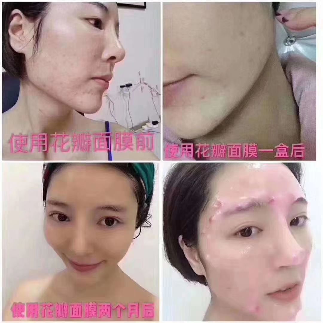 冰亦花瓣面