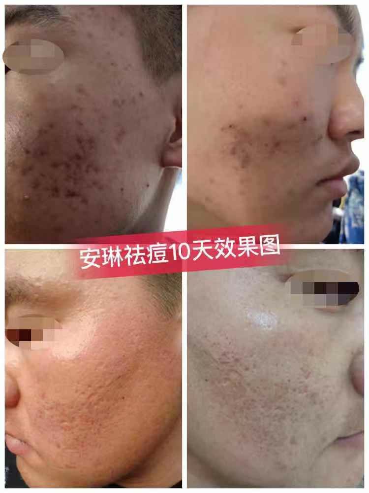 减肥养生美容
