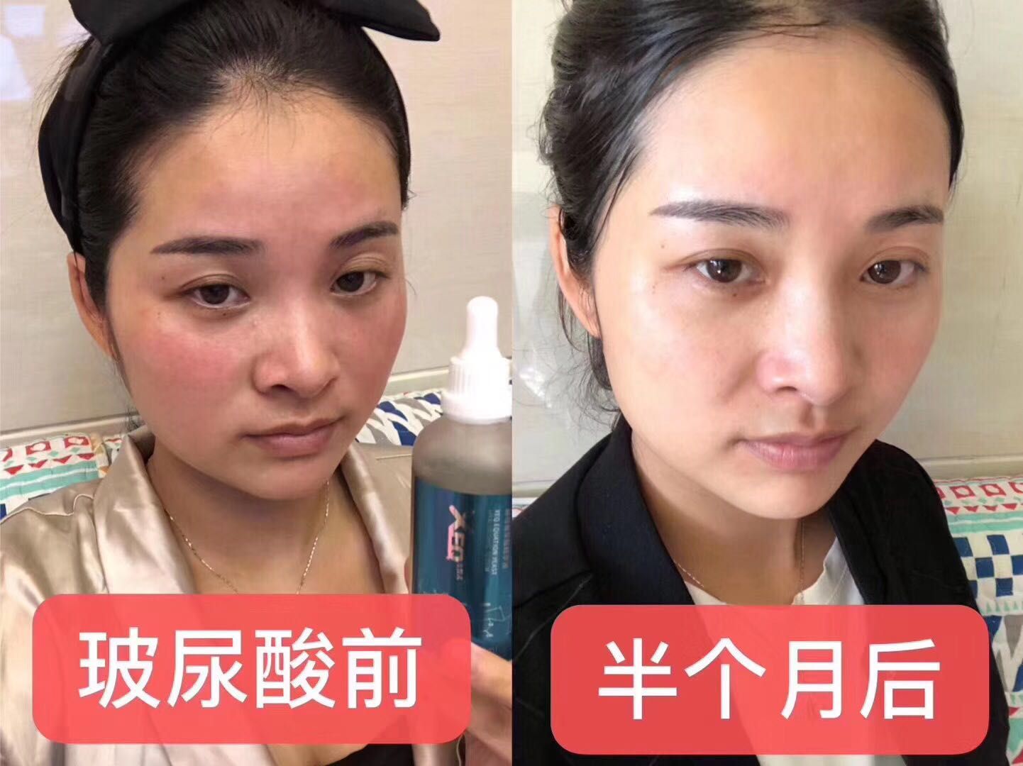 EXQ酵母玻尿酸，给你一份事业的产品！！！