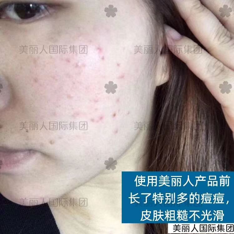 美丽人水晶皂
