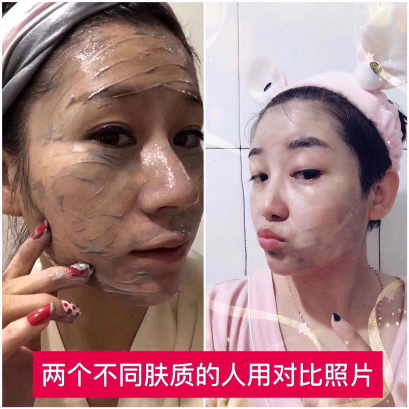 微晶是一款清洁神器，利用竹炭微晶粒子对毛孔进行清洁！