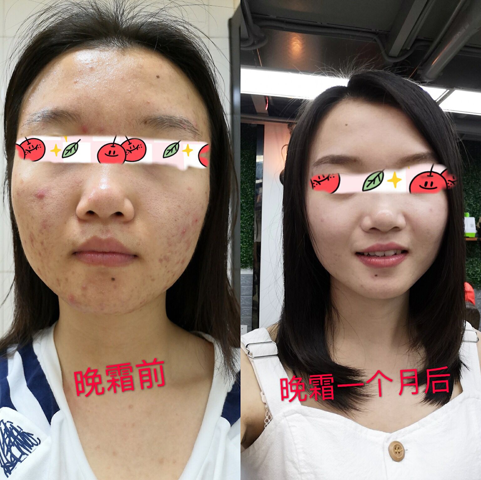 祛痘美白晚霜 纯天然无添加