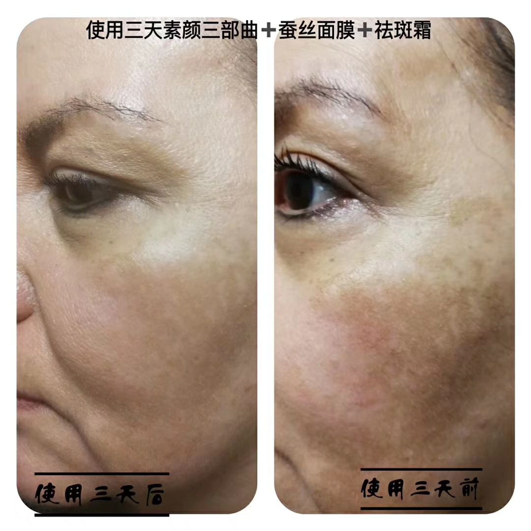 麦吉丽4000可拿下代理，后期无需退货