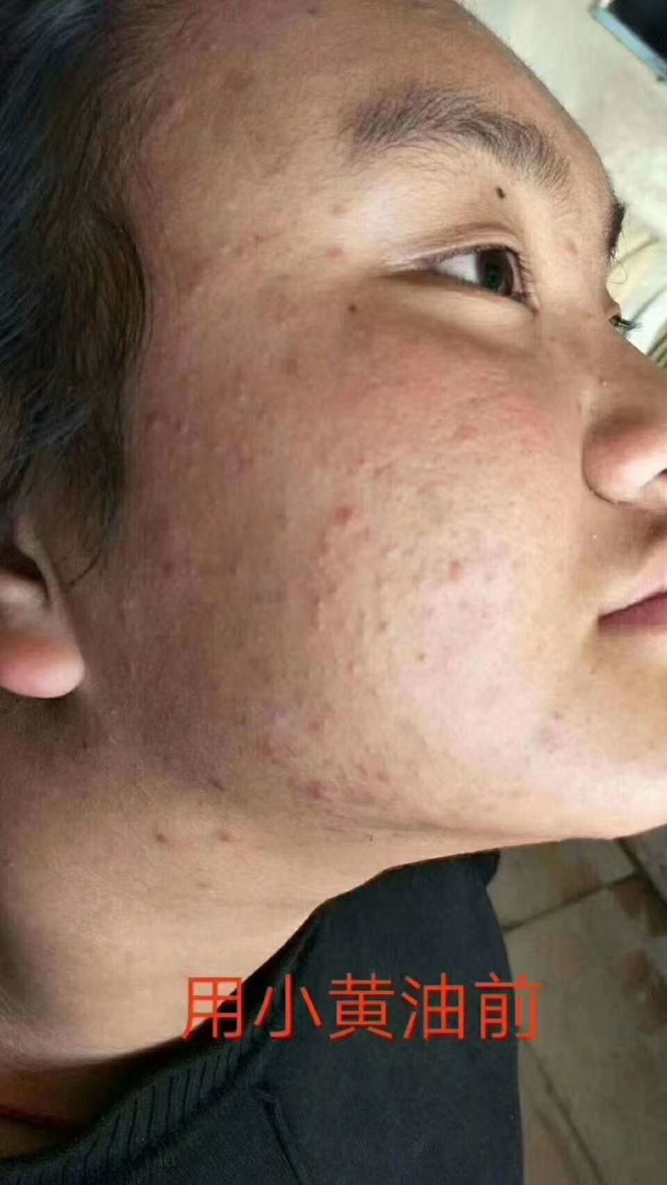 娜兰蒂姿小黄油套装