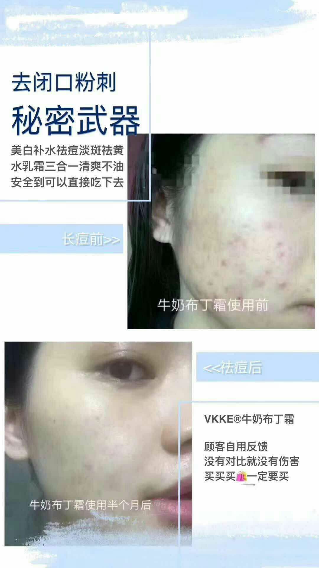 ᏉᏦᏦᎬ让你拥有好肌肤❤