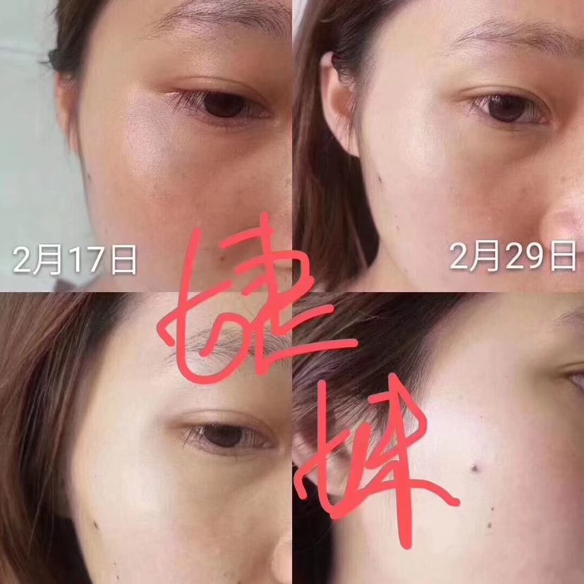 芙瑞塔美白饮 正品诚邀代理 一件代发158