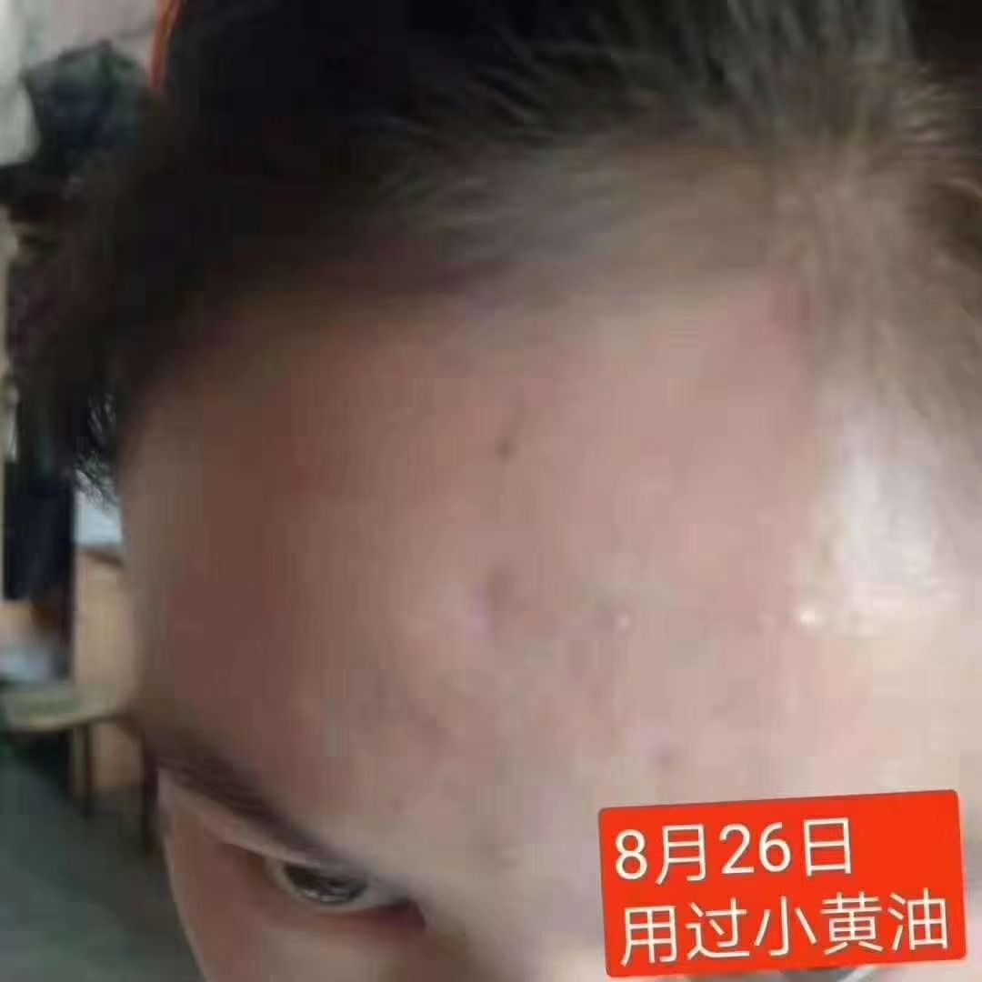 娜兰蒂姿小黄油套装