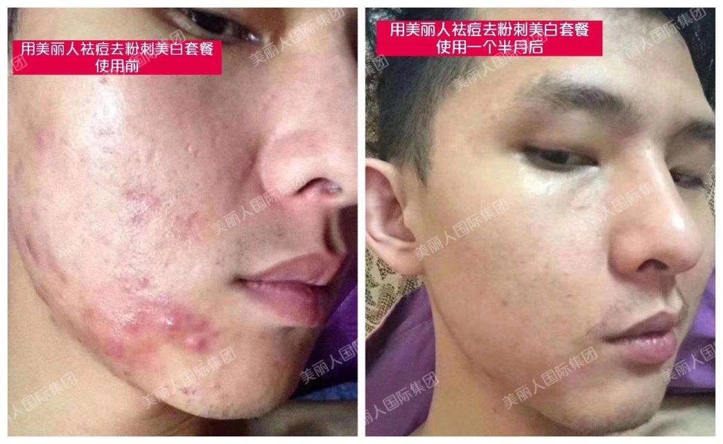 美丽人人商，台湾进口水晶皂