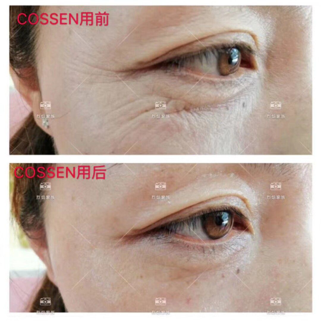 活性胶原眼膜 超级服帖 自带营养 滋养肌肤