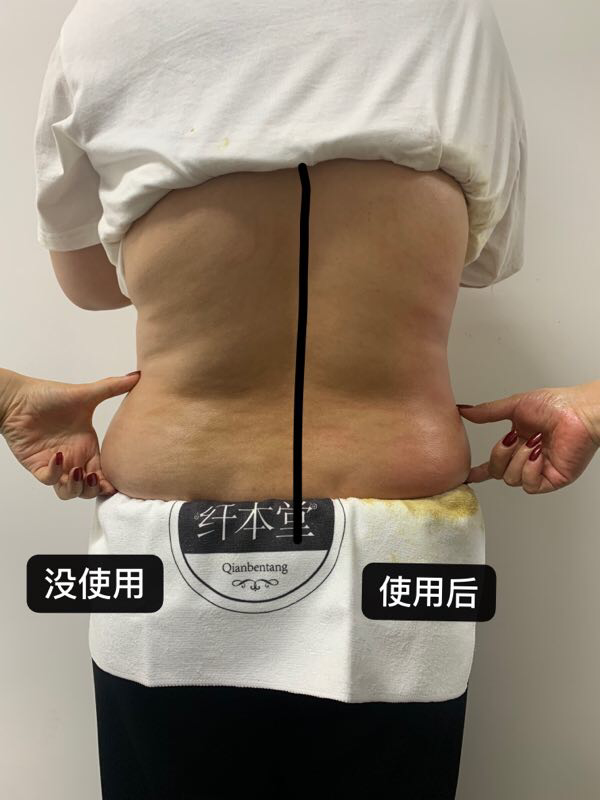 纤本堂拍拍瘦，一分钟立瘦三厘米。GPT黄金线雕，5分钟去皱