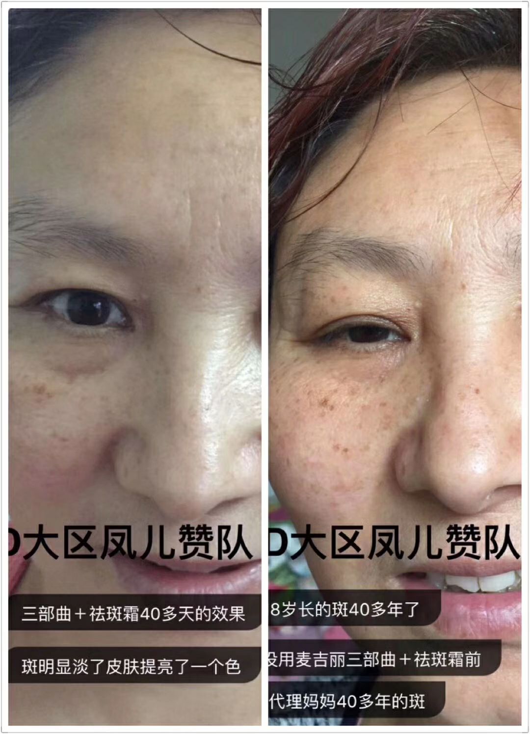 麦吉丽4000可拿下代理，后期无需退货