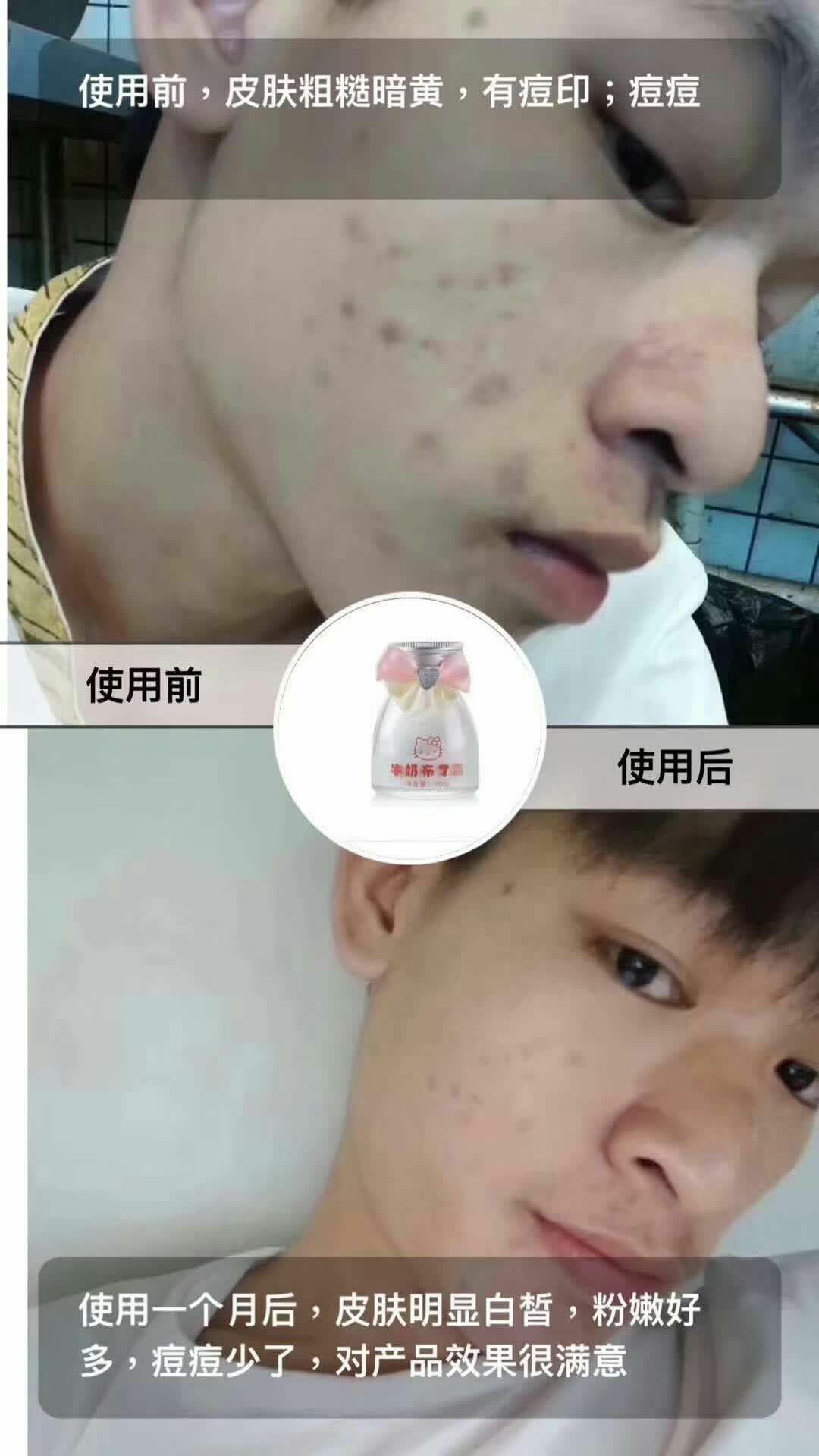 ᏉᏦᏦᎬ让你拥有好肌肤❤