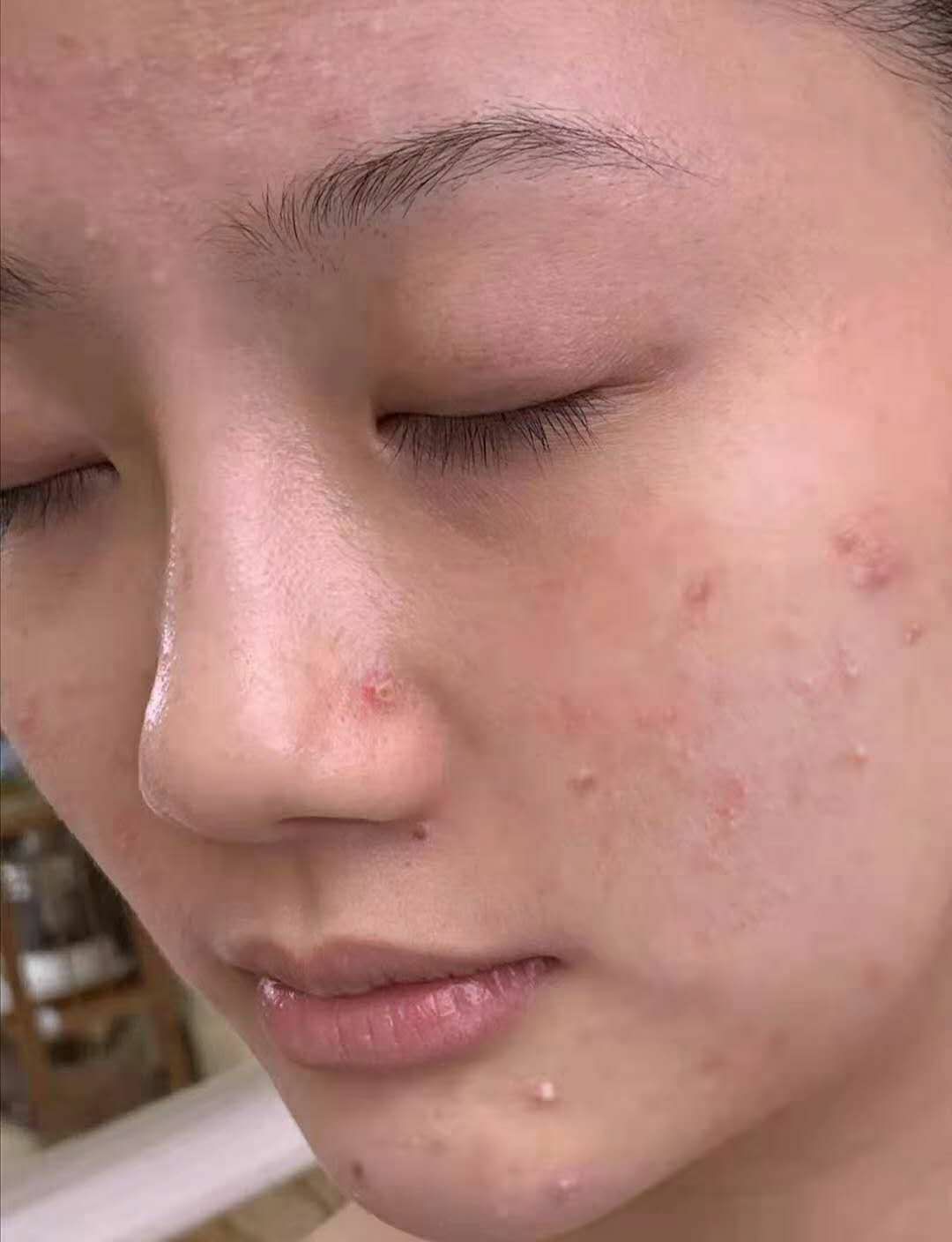 修护冻干粉。