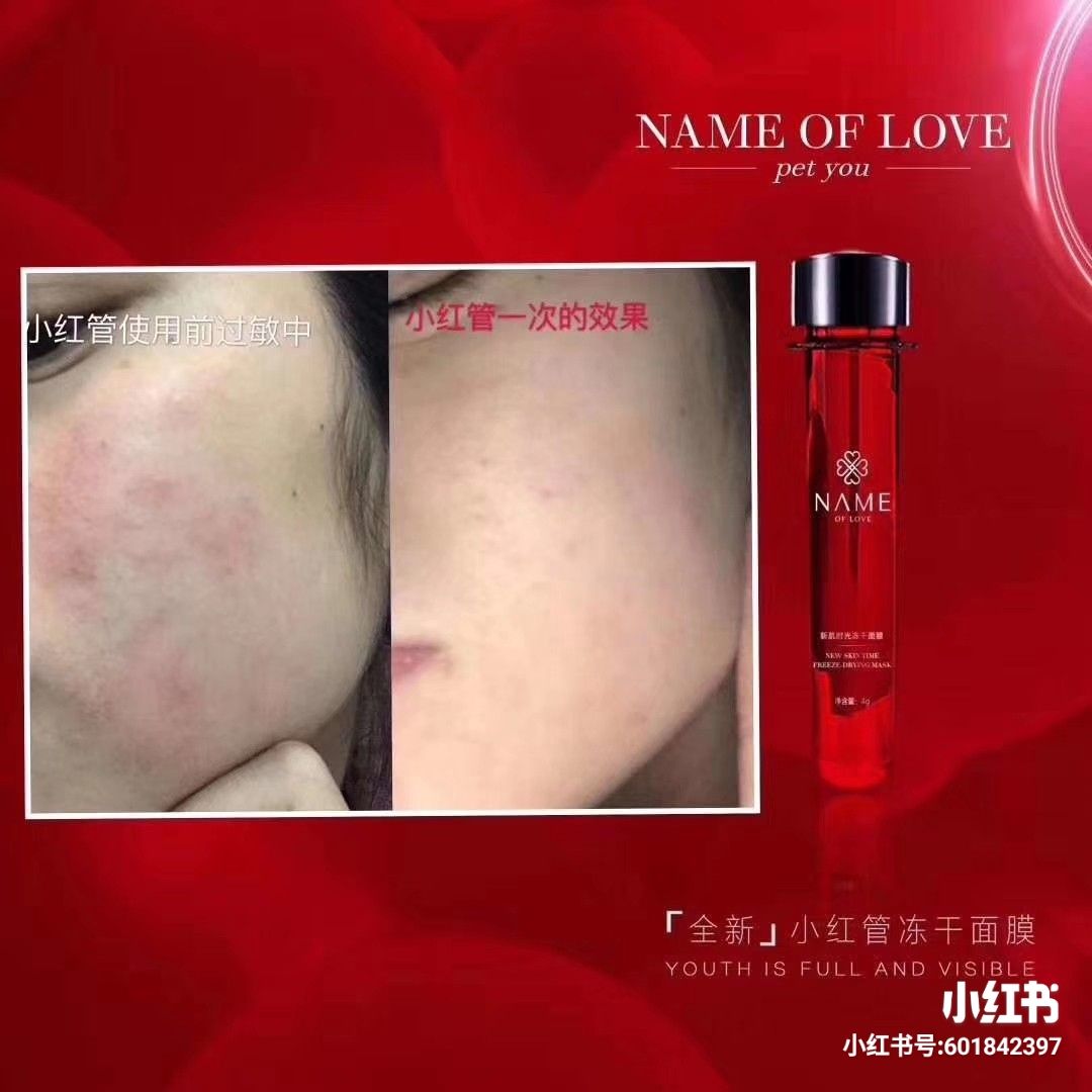 小红管面膜 美白淡斑祛痘印 超服帖 巨好用