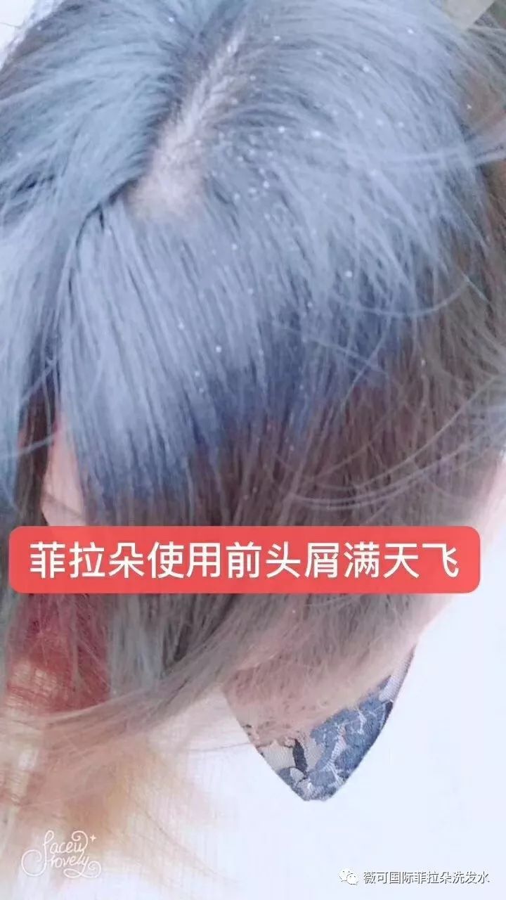 菲拉朵无硅油银离子深层净化洗护套装