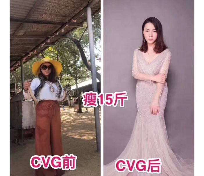 CVG燕窝膳食 月瘦5-15斤，本人自用月瘦20斤